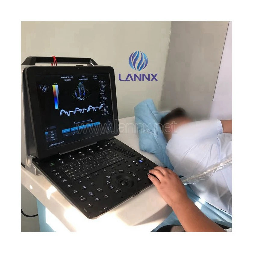 LANNX uDult P8 Most Popular medical ultrasonido 3D 4D portable color Doppler ultrasound Trolley hospital use Ultrasound Scanner