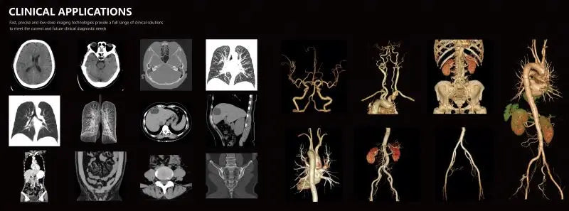 On-site installation!! Professional After-sales Team!!! Medical Computed Tomography 24 32 Slice CT Scanner CT Scan Machine