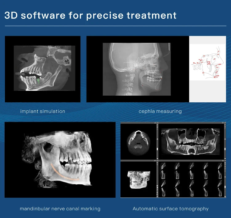 3D Imaging oral cbct Dental Cone beam Computer Tomography X Ray Scanning machine with cephalometric