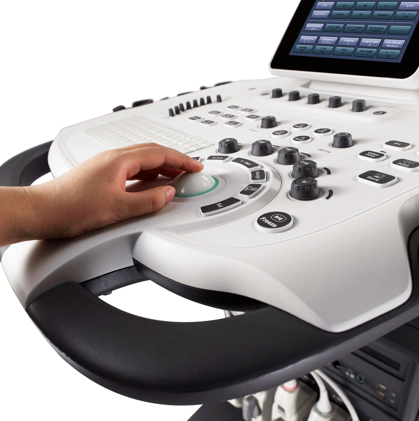 Smart Color Trolley Ultrasound machine, SonoScape S40 Doppler