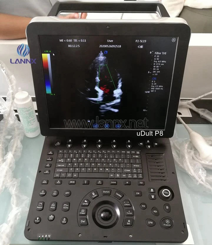 LANNX uDult P8 Most Popular medical ultrasonido 3D 4D portable color Doppler ultrasound Trolley hospital use Ultrasound Scanner