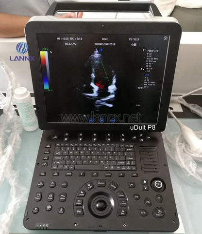 LANNX uDult P8 Most Popular medical ultrasonido 3D 4D portable color Doppler ultrasound Trolley hospital use Ultrasound Scanner