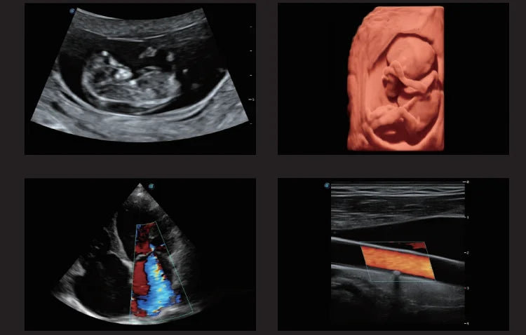 High quality sonoscape 4d 3d ultrasound machine ultrasonido veterinariy human ultrasounde scanner