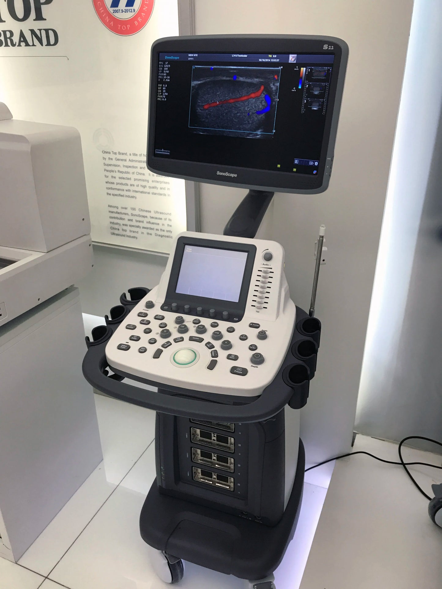 S22 SonoScape Ultrasound/3D&4D  SonoScape Ultrasound/S serious 3D&4D  SonoScape Ultrasound