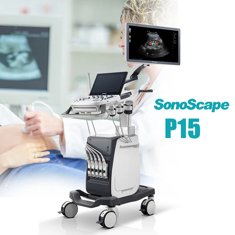 3D/4D  Snoscape P15 Diagnostic Color Doppler Ultrasound