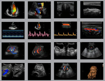 Sonoscape S9 Ultrasound Scanner Price Medical Ultrasound Instruments Portable 3D 4D Color Doppler Ultrasound Machine