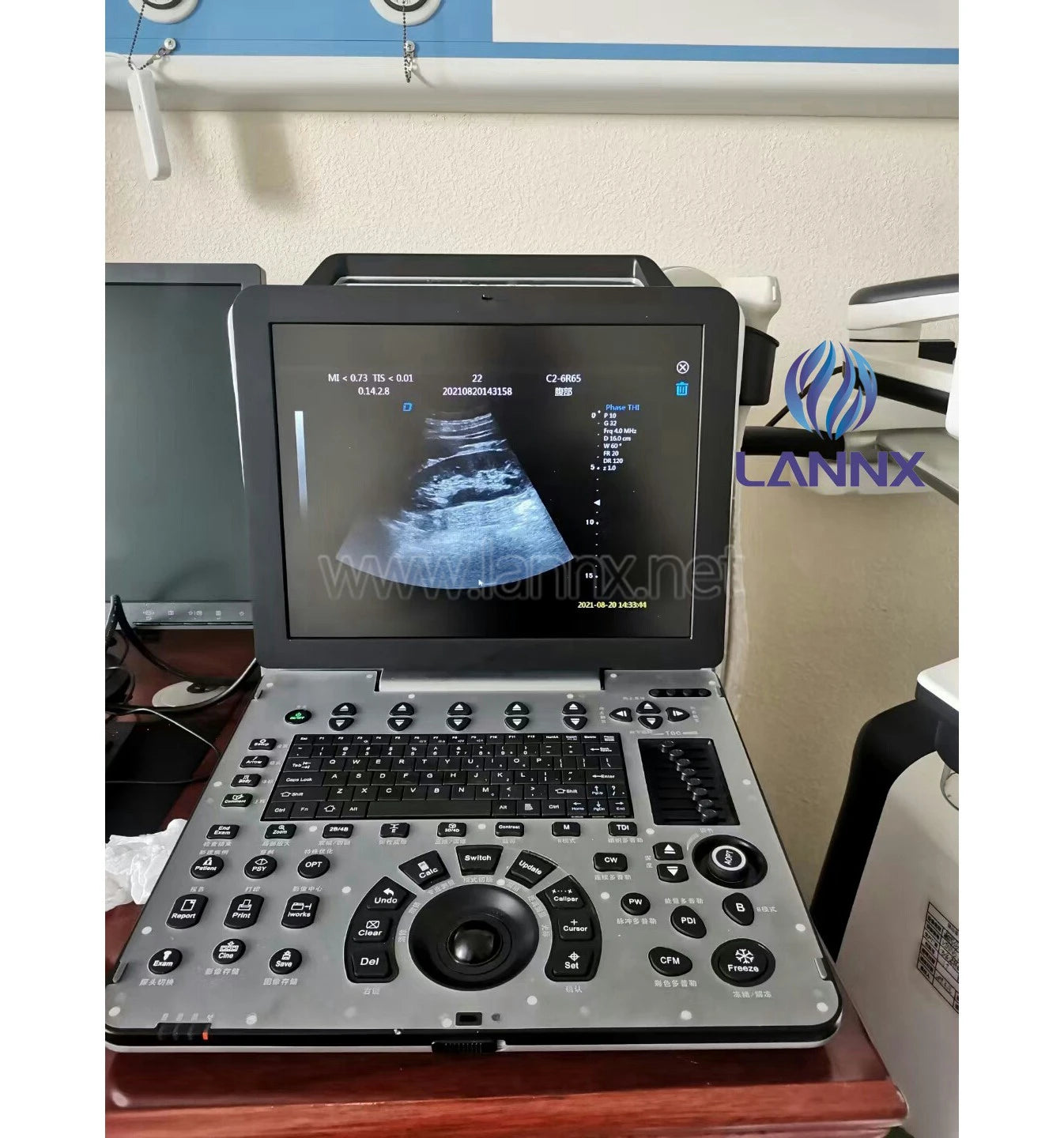LANNX uDult P8 Most Popular medical ultrasonido 3D 4D portable color Doppler ultrasound Trolley hospital use Ultrasound Scanner