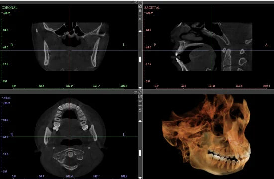 Ginee Medical Panoramic Dental X-ray Cbct 3d Panoramic Dental Machine Oral Scanner Dental cavity instruments digital unit CBCT