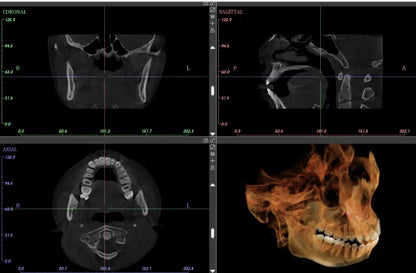 Ginee Medical Panoramic Dental X-ray Cbct 3d Panoramic Dental Machine Oral Scanner Dental cavity instruments digital unit CBCT
