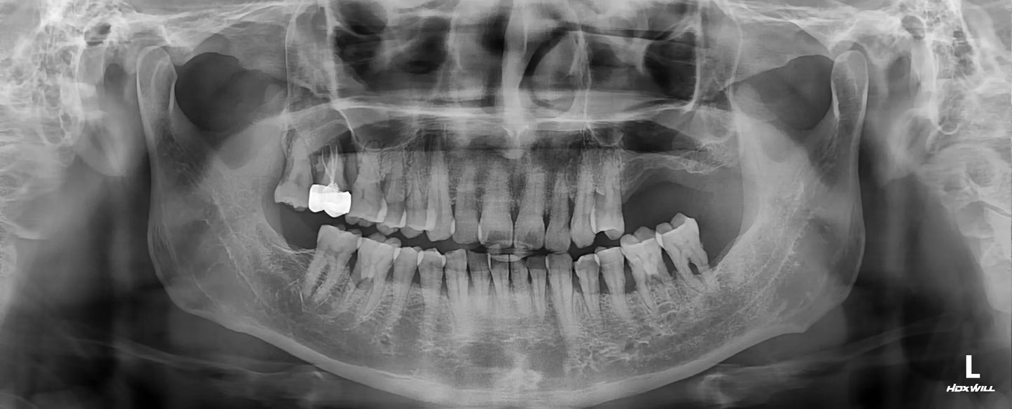 Used DENTRI-S 3-in-1cbct dental x ray machine with cephalometric