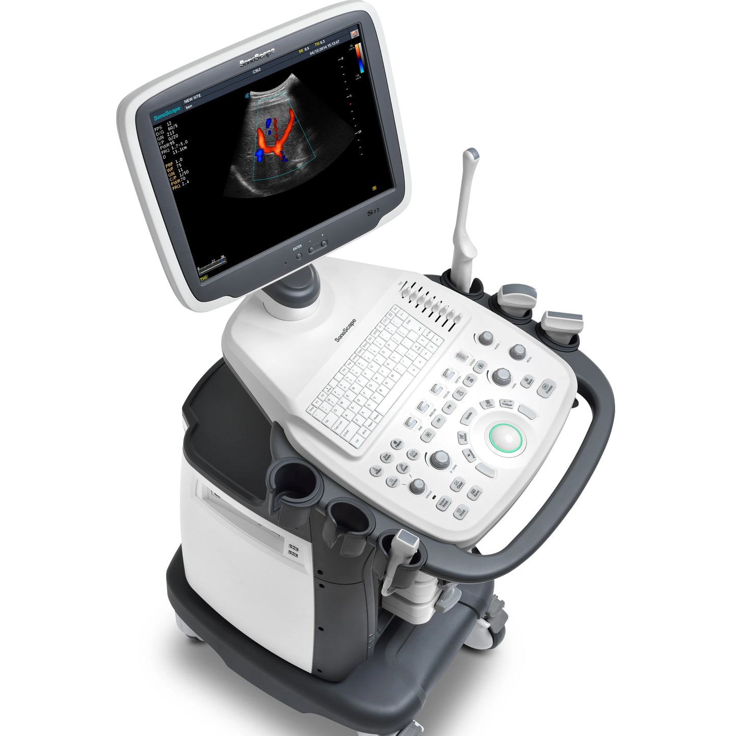 SonoScape S12 digital 3D/4D medical ultrasonic diagnosis system echocardiography machine ultrasound echo machine