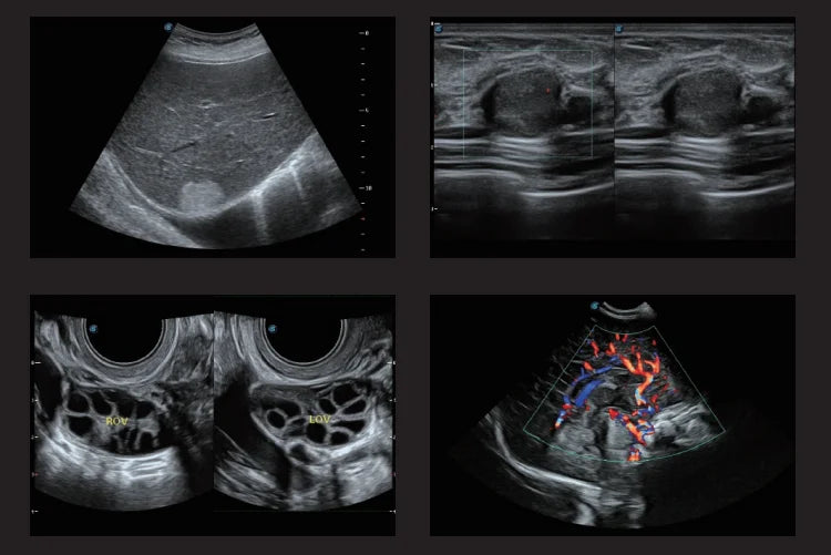 High quality sonoscape 4d 3d ultrasound machine ultrasonido veterinariy human ultrasounde scanner