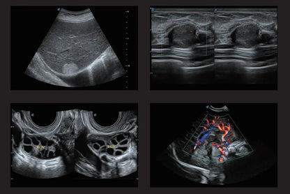 High quality sonoscape 4d 3d ultrasound machine ultrasonido veterinariy human ultrasounde scanner