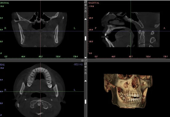 Ginee Medical Panoramic Dental X-ray Cbct 3d Panoramic Dental Machine Oral Scanner Dental cavity instruments digital unit CBCT