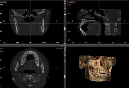 Ginee Medical Panoramic Dental X-ray Cbct 3d Panoramic Dental Machine Oral Scanner Dental cavity instruments digital unit CBCT