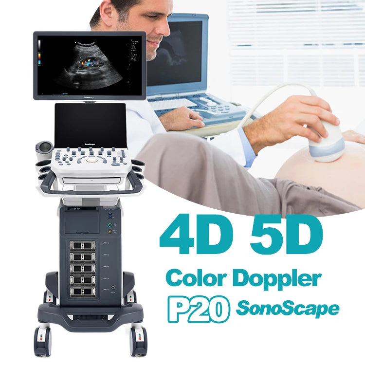 High quality sonoscape 4d 3d ultrasound machine ultrasonido veterinariy human ultrasounde scanner