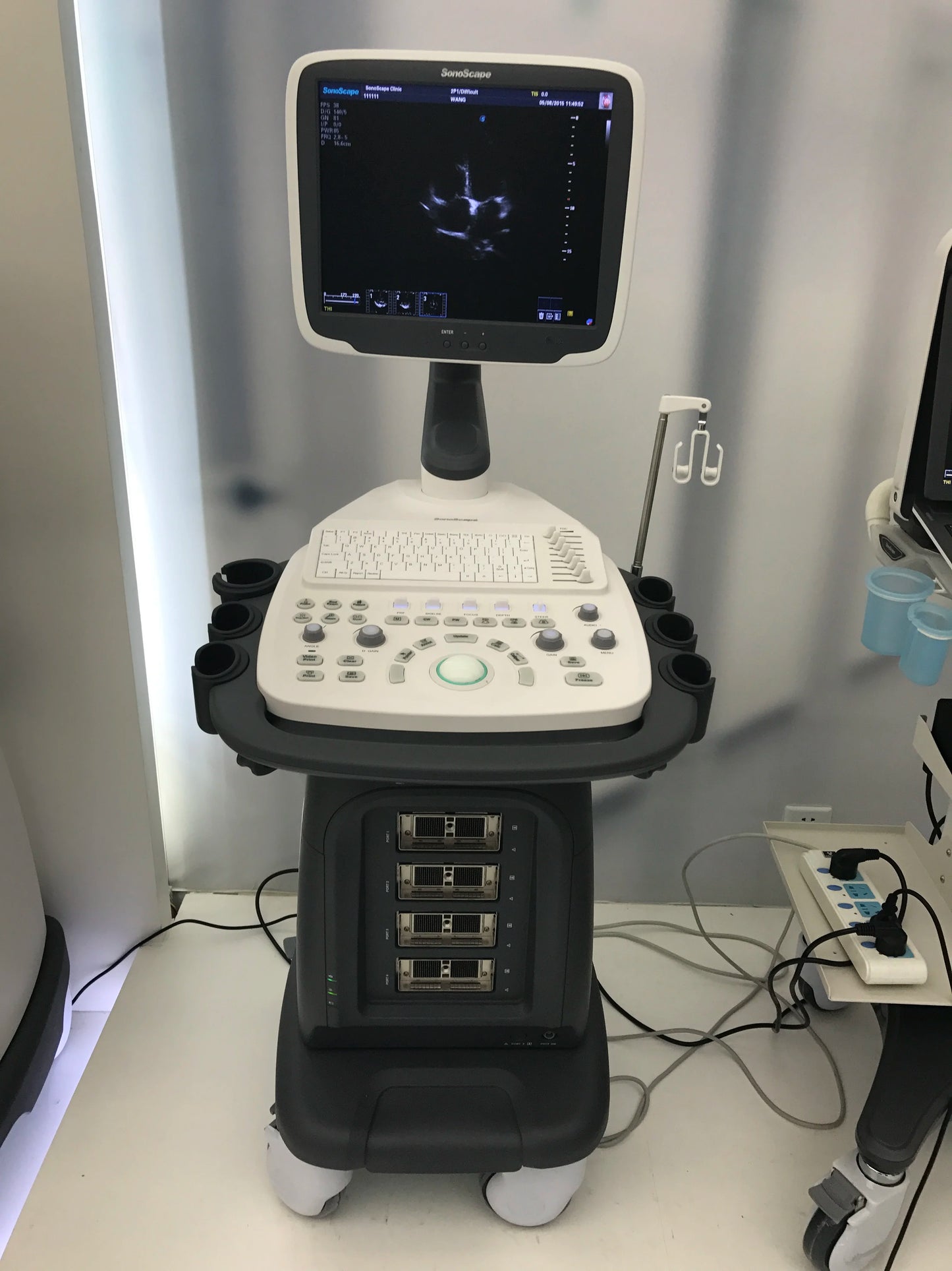 SonoScape S12 digital 3D/4D medical ultrasonic diagnosis system echocardiography machine ultrasound echo machine