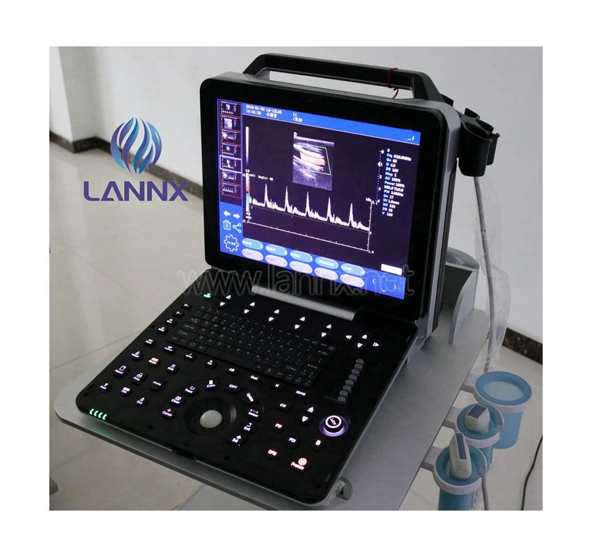 LANNX uDult P8 Most Popular medical ultrasonido 3D 4D portable color Doppler ultrasound Trolley hospital use Ultrasound Scanner