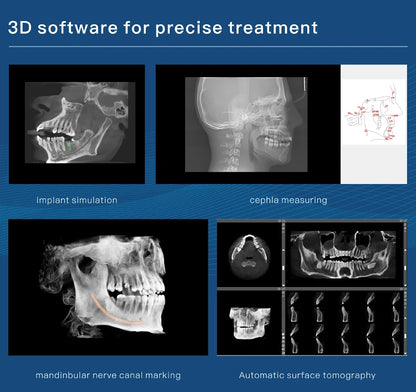 3D Imaging oral cbct Dental Cone beam Computer Tomography X Ray Scanning machine with cephalometric