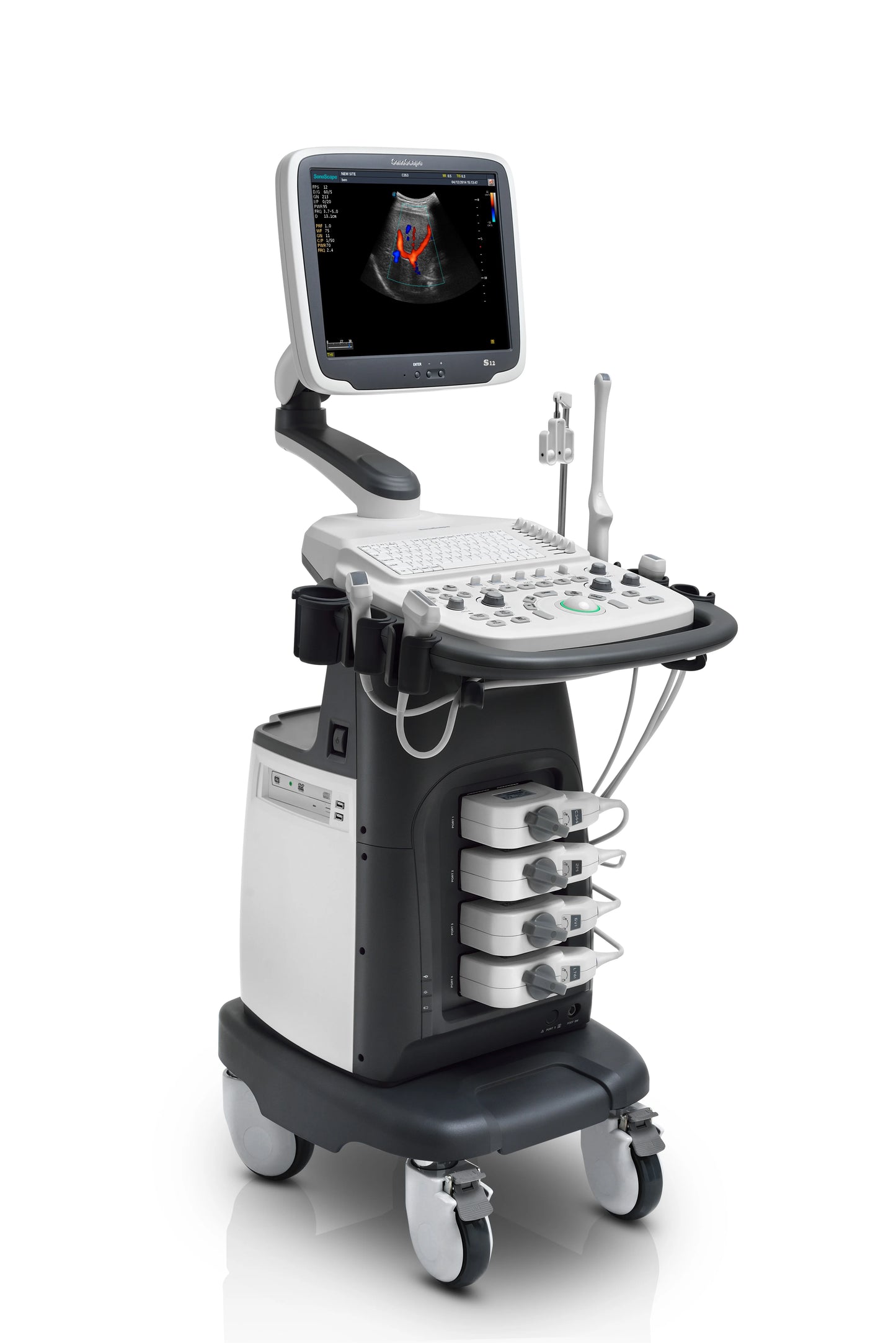 SonoScape S12 digital 3D/4D medical ultrasonic diagnosis system echocardiography machine ultrasound echo machine