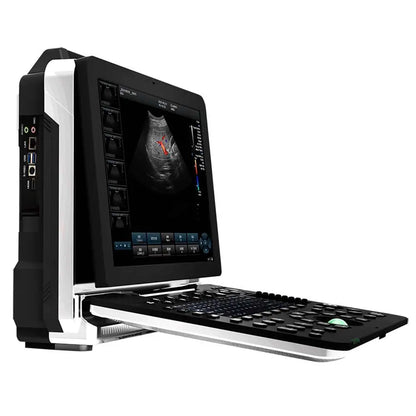 Good Price Ultrasound Machine High Quality