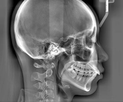 Ginee Medical Panoramic Dental X-ray Cbct 3d Panoramic Dental Machine Oral Scanner Dental cavity instruments digital unit CBCT