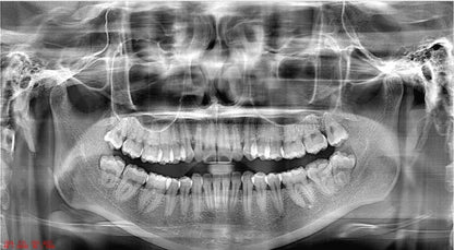 Ginee Medical Panoramic Dental X-ray Cbct 3d Panoramic Dental Machine Oral Scanner Dental cavity instruments digital unit CBCT