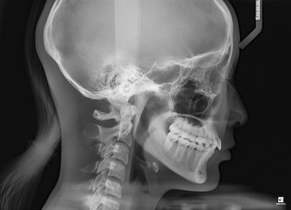Used DENTRI-S 3-in-1cbct dental x ray machine with cephalometric