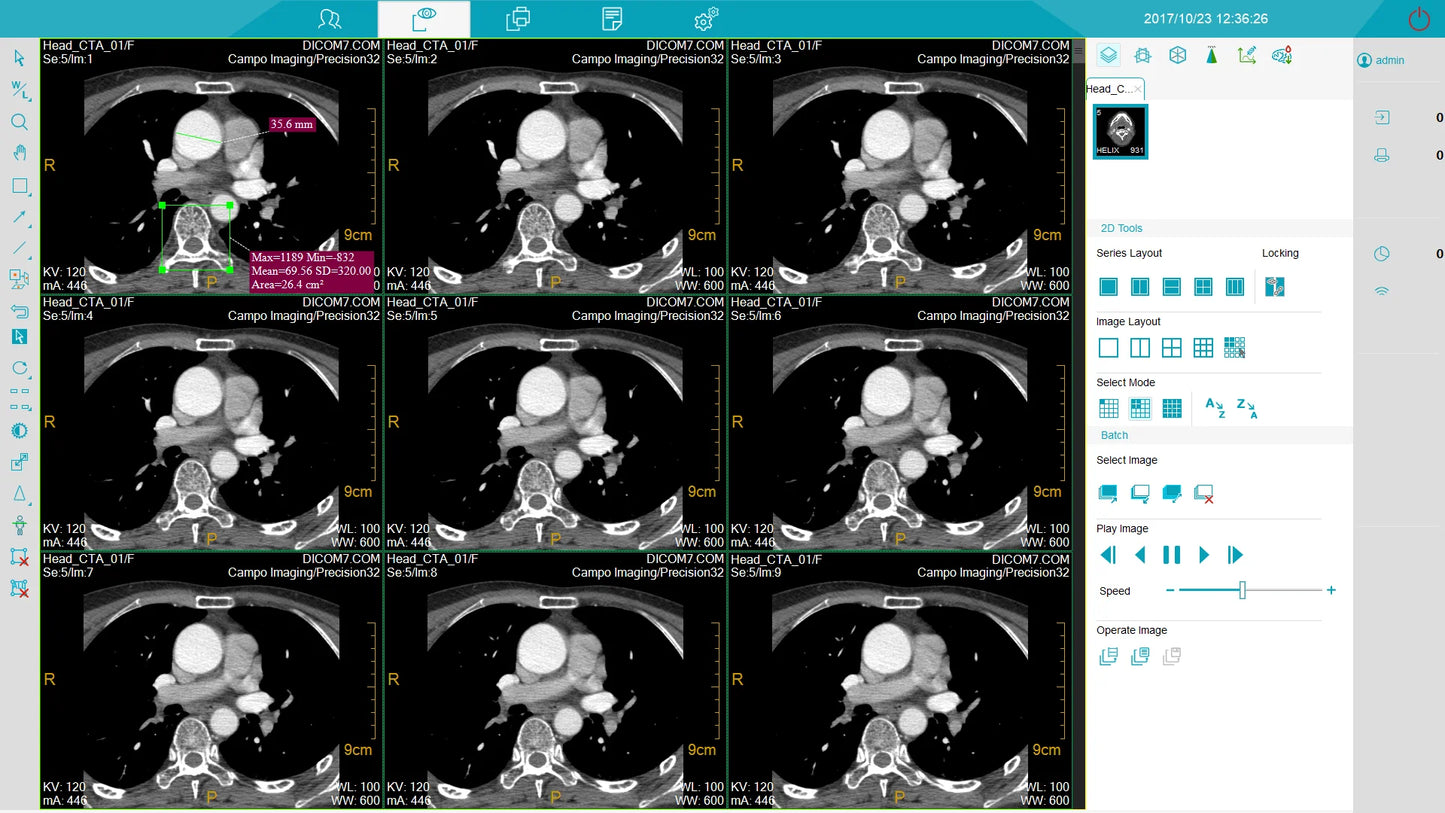 Medical equipment professional Scan  Tomography CT scanner for human and Vet