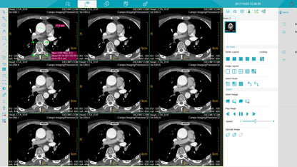 Medical equipment professional Scan  Tomography CT scanner for human and Vet