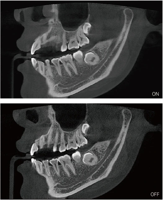 High End 3 in 1 Digital  Dental Panoramic Xray Machine  Teeth Head Imaging 3D cbct Dental X Ray  Equipment