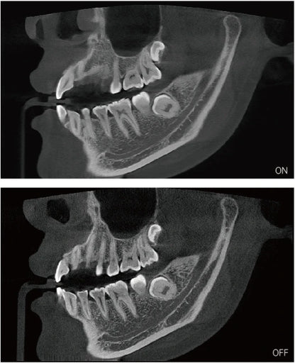 High End 3 in 1 Digital  Dental Panoramic Xray Machine  Teeth Head Imaging 3D cbct Dental X Ray  Equipment