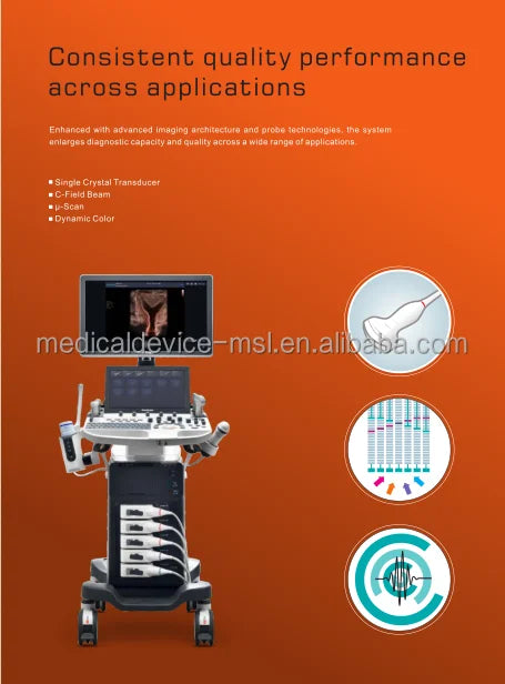 Sonoscape P50 ultrasound machine with color doppler echo detection