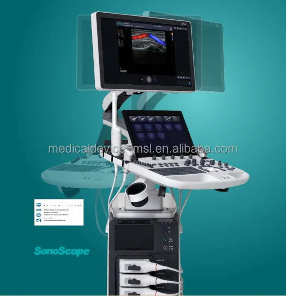 Sonoscape P50 ultrasound machine with color doppler echo detection