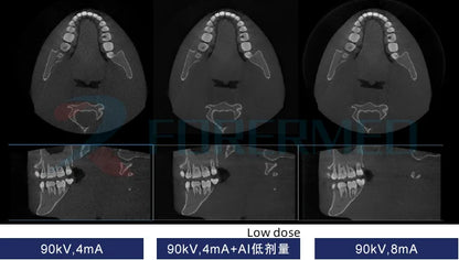 High End 3 in 1 Digital  Dental Panoramic Xray Machine  Teeth Head Imaging 3D cbct Dental X Ray  Equipment