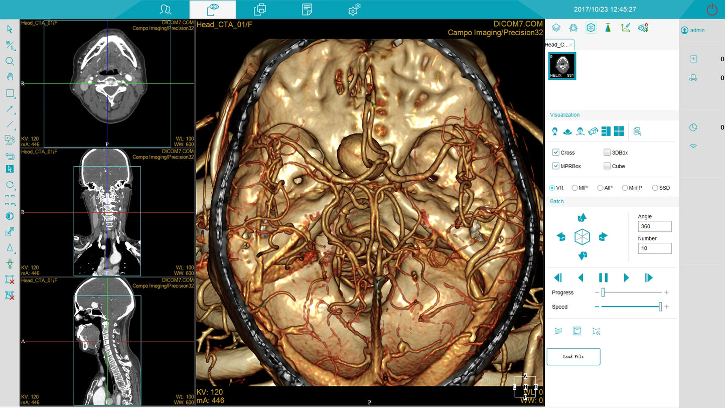 Medical equipment professional Scan  Tomography CT scanner for human and Vet