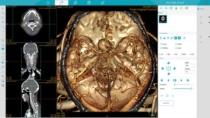 Medical equipment professional Scan  Tomography CT scanner for human and Vet