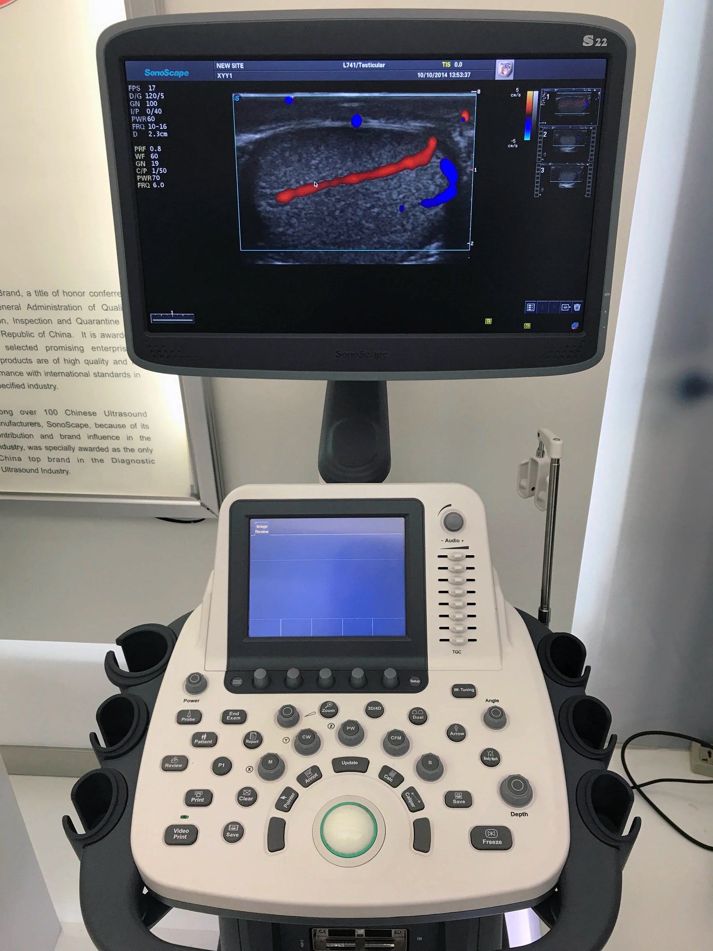 S22 SonoScape Ultrasound/3D&4D  SonoScape Ultrasound/S serious 3D&4D  SonoScape Ultrasound