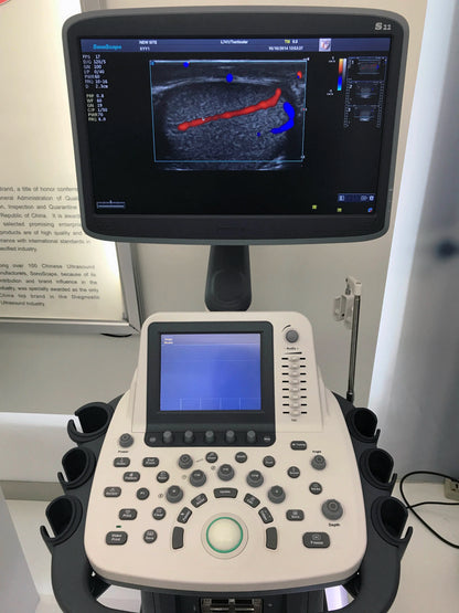S22 SonoScape Ultrasound/3D&4D  SonoScape Ultrasound/S serious 3D&4D  SonoScape Ultrasound