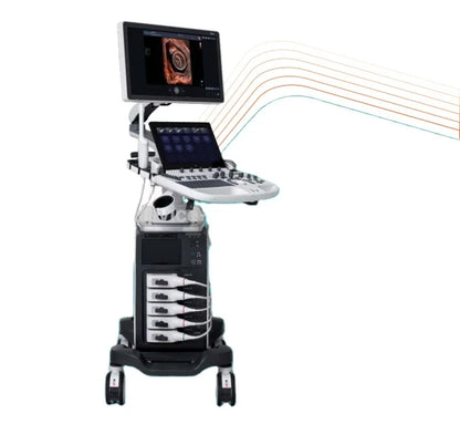 Sonoscape P50 ultrasound machine with color doppler echo detection