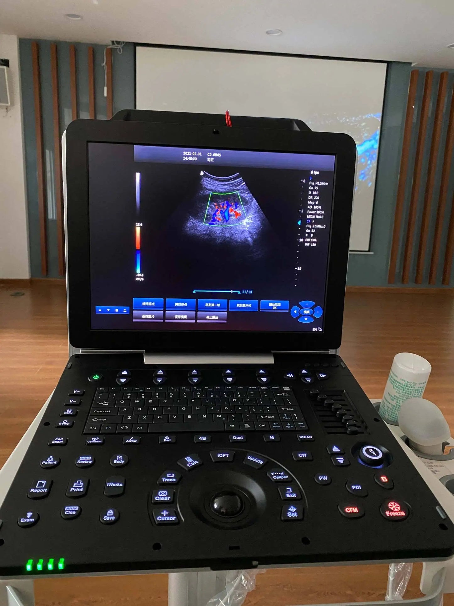 Good Price Ultrasound Machine High Quality