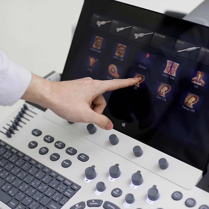 Sonoscape P40 Elite Digital 4D 5D Ultrasound Scanner OB/GYN Diagnostic Trolley Color Doppler Ultrasound Machine