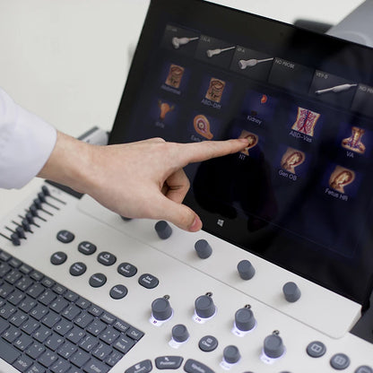 Sonoscape P40 Elite Digital 4D 5D Ultrasound Scanner OB/GYN Diagnostic Trolley Color Doppler Ultrasound Machine
